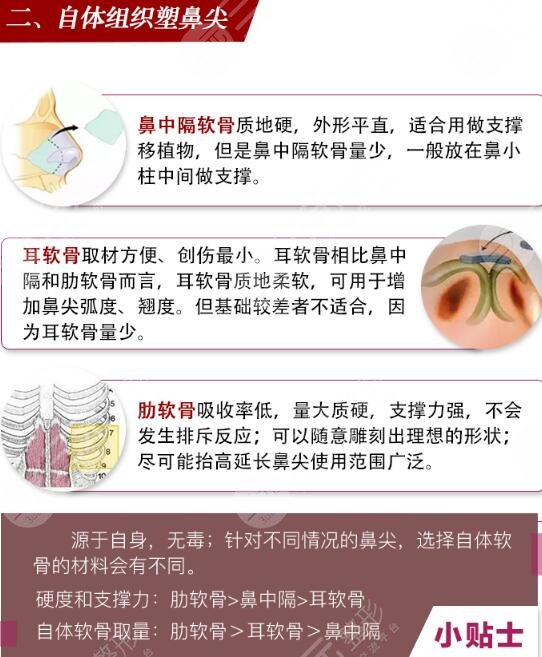 韩式鼻尖整形方法有哪些